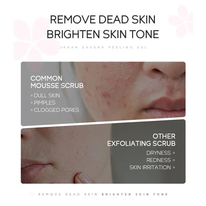 Sakura Peeling Gel Facial Exfoliation Cleans Pores Moisturizing Oil
