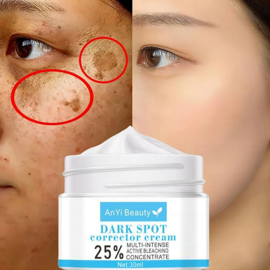 Whitening Freckles Cream Remove Melasma Dark Spot Lightening are
