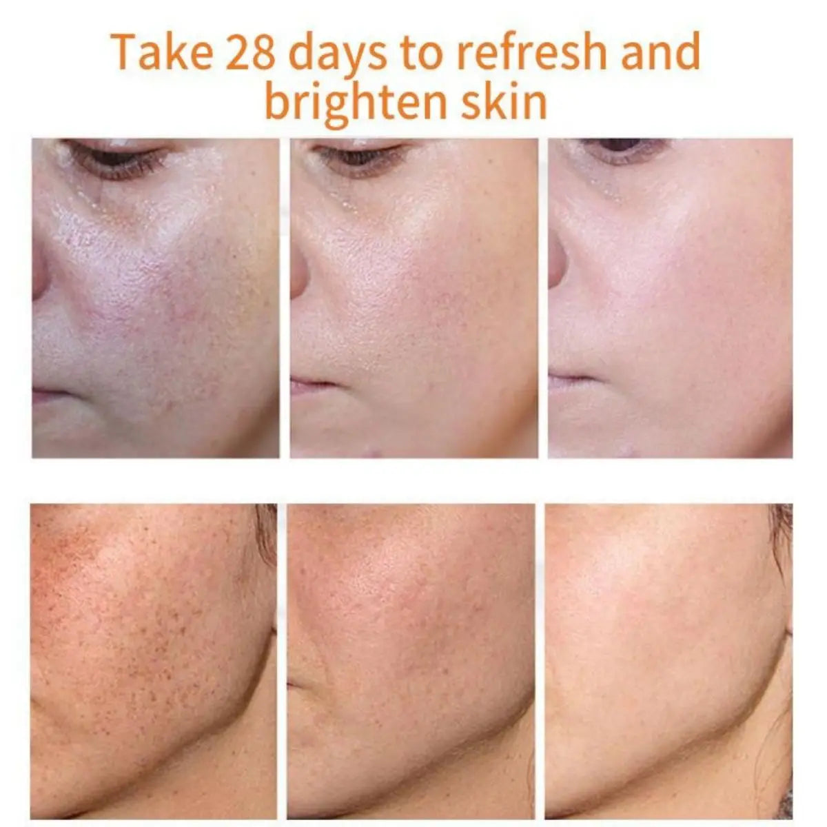 Whitening Freckles Cream Remove Melasma Dark Spot Lightening are