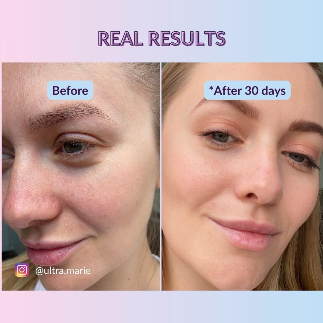 Hyaluronic Acid Serum with ORGANIC Aloe Vera - NATURAL COSMETICS VEGAN - Highly Concentrated - 30Ml - Intensive, Moisturising Face Care